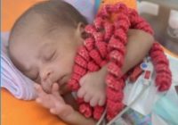 Rocha Faria utiliza polvos de crochê para auxiliar bebês prematuros